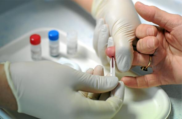 Rectifican cifras de operativos de testeos de VIH en la RM: Positividad es de 1,3% y no de 30%