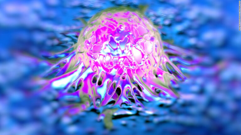 Medicamento contra el cáncer de ovarios arroja prometedores resultados en ensayos clínicos