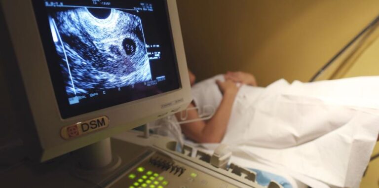 Aumenta objeción de conciencia en causal de violación: 46% de los obstetras se acogen al mecanismo para no realizar el procedimiento