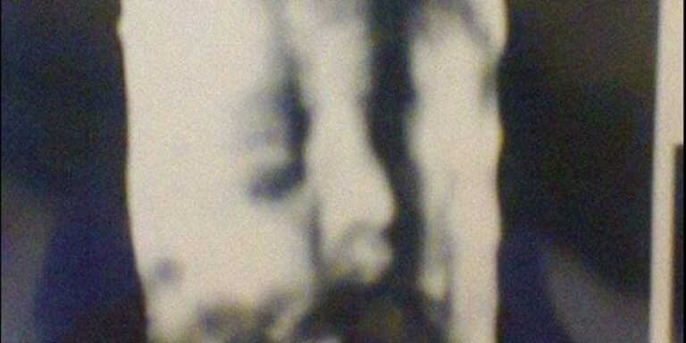 Denuncian a médico de entregar la misma ecografía 3D a decenas de embarazadas en el Maule