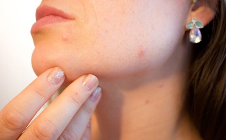 Ojo con la calefacción: 5 efectivos consejos para cuidar tu piel en invierno