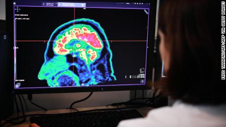 Los cinco tipos de cáncer más comunes y más mortales del mundo