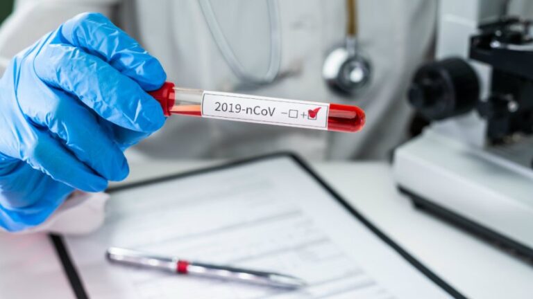 Servicio de Salud del Maule confirma que mujer de 21 años murió contagiada con COVID-19