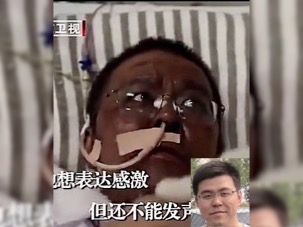 Médicos de Wuhan sufrieron un cambio en la pigmentación mientras eran tratados por COVID-19