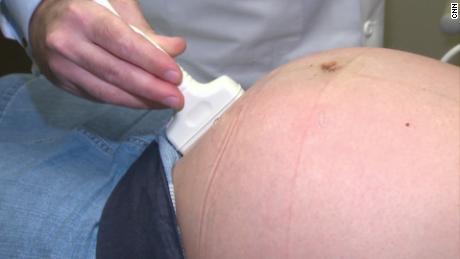 El desafío de ser madre en plena pandemia: Cómo evitar el contagio de los recién nacidos