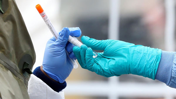 Informe epidemiológico: DEIS cifra en más de 11 mil las muertes a causa del COVID-19