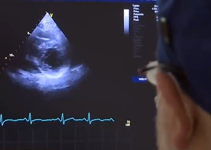 Hasta un 20% de pacientes con COVID-19 puede sufrir afecciones cardíacas incluso tras alta médica