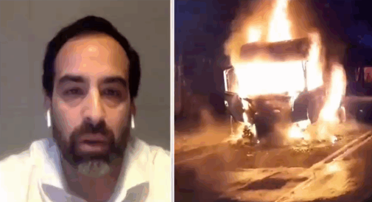 Chile Transportes tras quema que terminó con niña herida: 