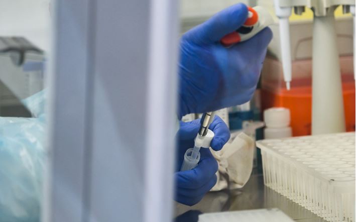 Minsal: Positividad en la RM alcanzó el 5,2% y roza lo recomendado por la OMS