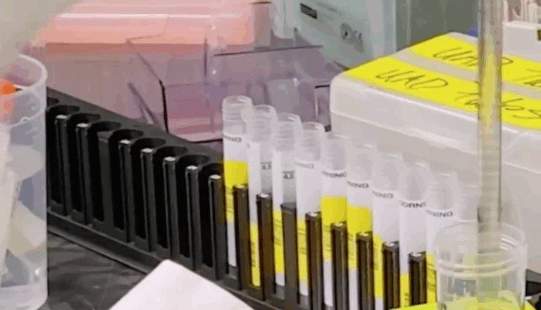 Las complicaciones de la vacuna de Pfizer: Debe ser almacenada a -70°C y suministrada en menos de 5 días