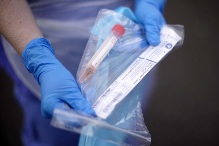 Informe Epidemiológico: Estas son las comunas con más casos activos de COVID-19