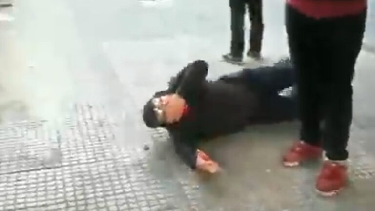 Reportero gráfico sufre trauma ocular tras recibir el impacto de un proyectil en medio de protestas