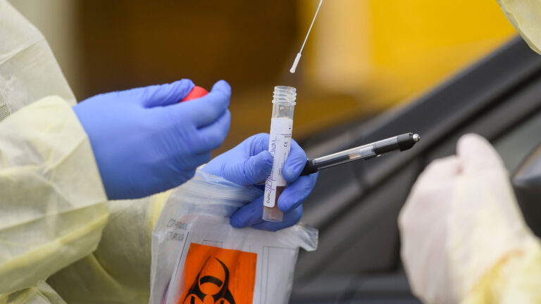 Variante británica de COVID-19: Se transmite más, pero no aumenta gravedad, según últimos estudios