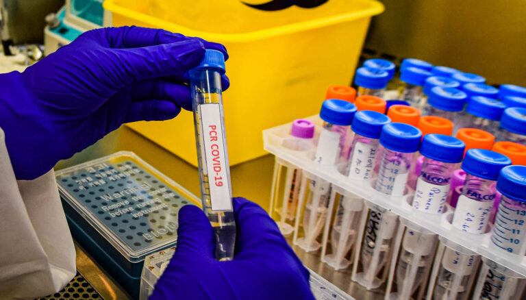 OMS: “El fin de la pandemia del coronavirus aún está más allá del horizonte”