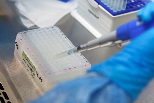 Minsal informa 921 nuevos casos de COVID-19 y la positividad más baja desde el comienzo de la pandemia