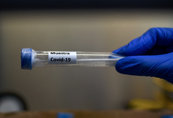 Casos activos de COVID-19 bajaron de los 4 mil por primera vez desde abril de 2020