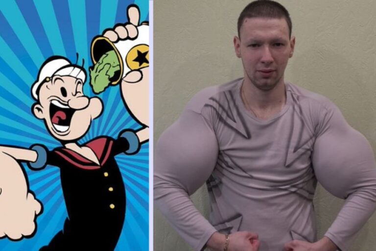 Brazos del ruso que quería tener los músculos de Popeye 
