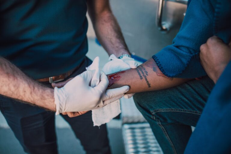 Crean parche que libera nanopartículas de plata cuando se producen infecciones en las quemaduras