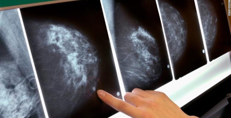 Estas son las innovaciones latinoamericanas que le entregan esperanza a los pacientes con cáncer