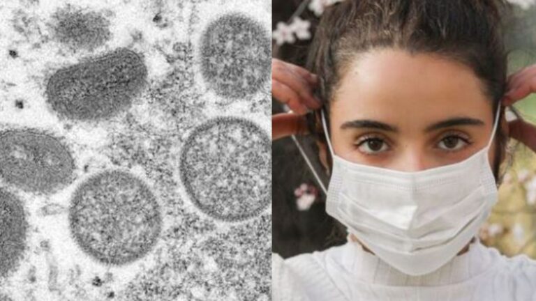 Virólogo y qué hacer ante síntomas de viruela del mono: “El uso de la mascarilla ayudará a que no se propague demasiado”