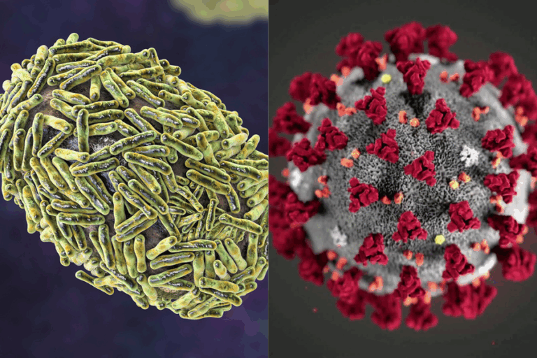 Viruela del mono y COVID-19: Las diferencias claves entre ambas emergencias sanitarias