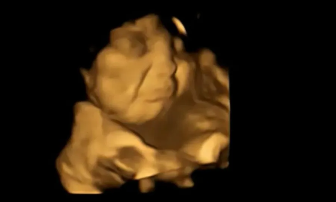 Estudio revela que los fetos sonríen con el sabor de la zanahoria y hacen mueca de disgusto con el kale