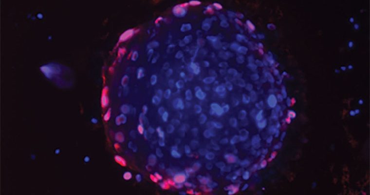 Científicos identifican prometedor fármaco contra el cáncer de próstata