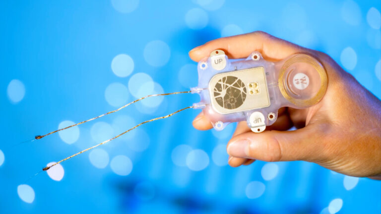 Arnau Espinosa y el implante cerebral que le devolvió 