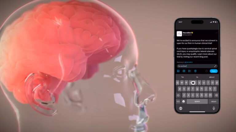 A propósito de Neuralink: Qué es un implante cerebral humano, cómo funciona y cuándo estará disponible