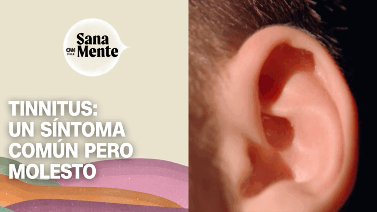 Tinnitus: Un fenómeno que afecta al 20% de la población