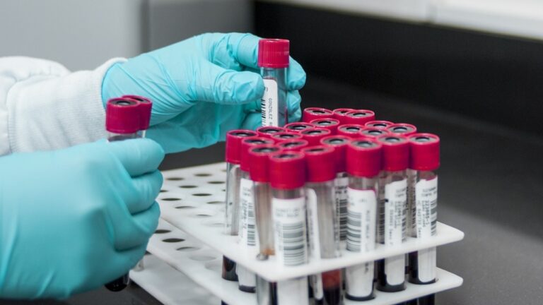 Histórico: Logran la primera curación de VIH con trasplante de células madre sin mutación protectora