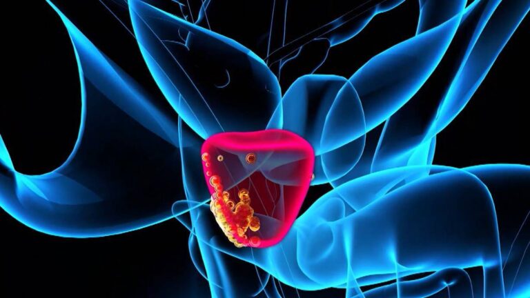 Chile avanza en la lucha contra el cáncer con inteligencia artificial y recursos naturales