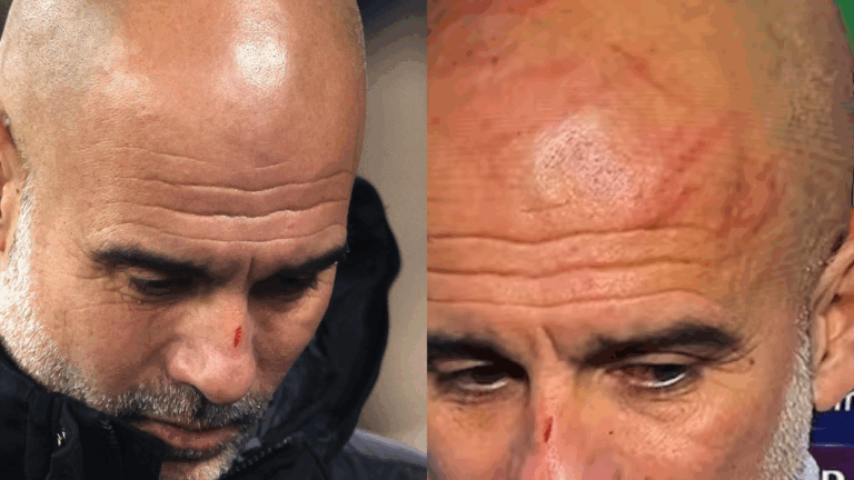 Guardiola aclara sus heridas tras el amargo empate ante el Feyenoord: 