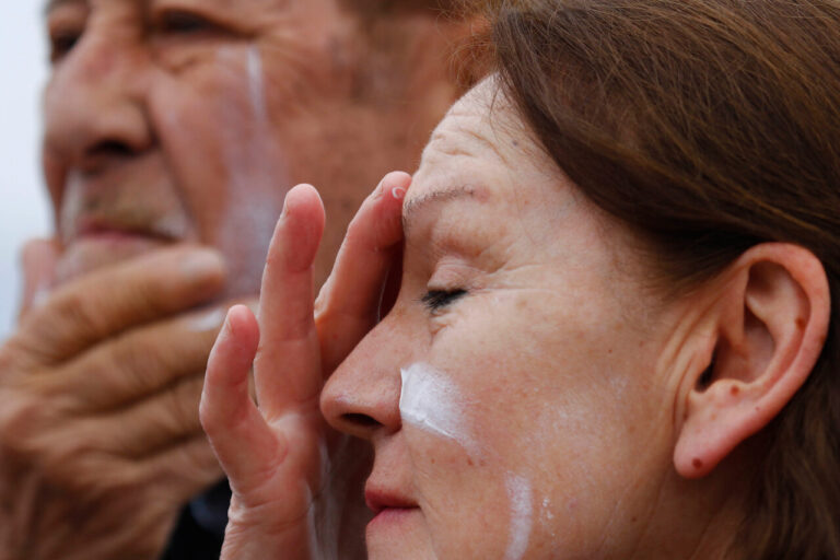 Dermatóloga da las claves: ¿Cuáles son cuidados que necesita la piel en verano?