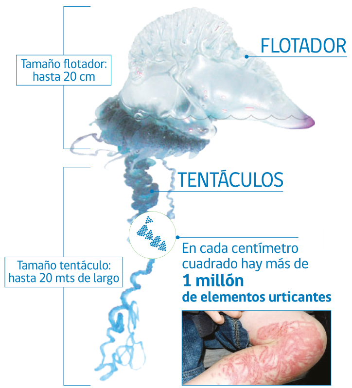 Temporada de verano: ¿Qué hacer si te picó una fragata portuguesa?/Gobierno