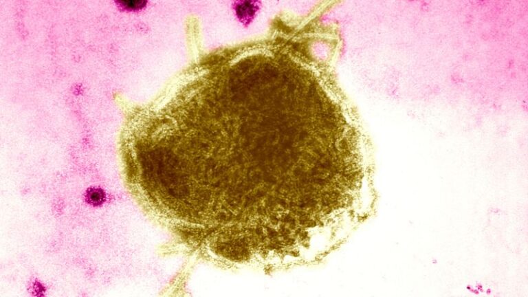 Niño murió por sarampión en Estados Unidos, primer caso fatal en una década: No estaba vacunado