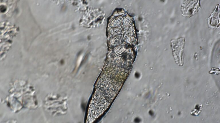 Mientras duermes, estos bichos te hacen una fiesta en la cara