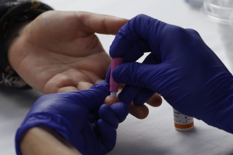 Mitos sobre el VIH: ¿Cuál es la diferencia entre SIDA y VIH?