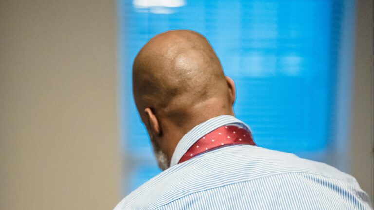 ¿La calvicie es hereditaria? Especialista aclara los mitos más repetidos