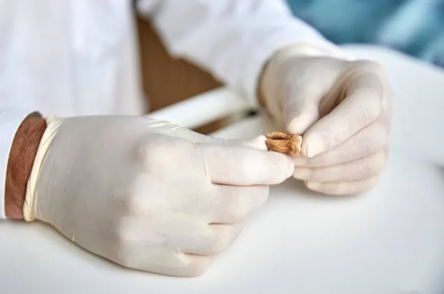 Un diente utilizado para análisis de ADN antiguo durante el estudio del ejército de Napoleón. Claudio Centonze/Comisión Europea