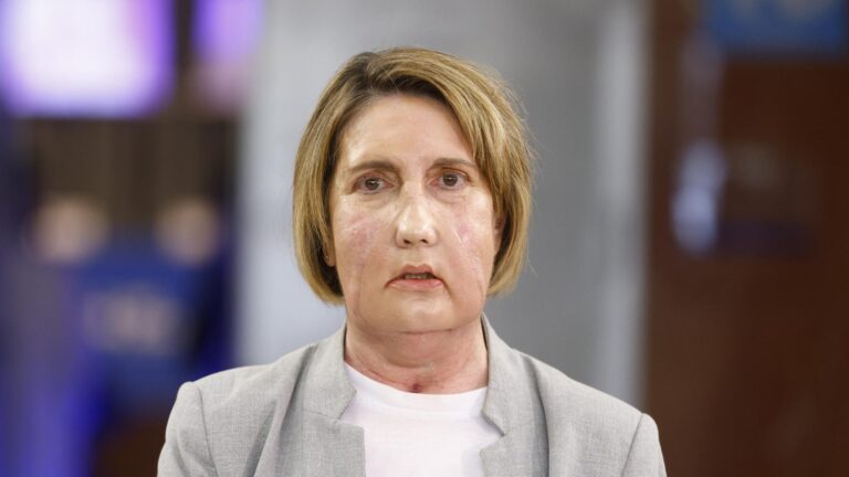 Realizan el primer trasplante de cara del mundo con una donante que recibió eutanasia